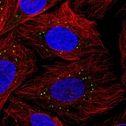 Immunofluorescent staining of human cell line SiHa shows localization to vesicles.