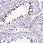 Anti-C4orf33 Antibody