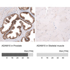 Anti-ADAM10 Antibody