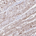 Anti-ZNF736 Antibody