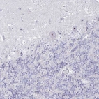Anti-DLK2 Antibody