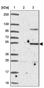 Lane 1: Marker [kDa] 250, 130, 95, 72, 55, 36, 28, 17, 10_br/_Lane 2: Human cell line RT-4_br/_Lane 3: Human cell line U-251MG sp