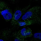 Immunofluorescent staining of human cell line U-251 MG shows localization to vesicles.