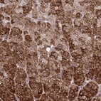 Anti-LIMS1 Antibody