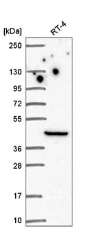 Western blot analysis in human cell line RT-4.