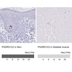 Anti-PSORS1C2 Antibody