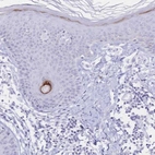 Immunohistochemical staining of human skin shows high expression.