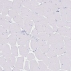 Anti-PSORS1C2 Antibody