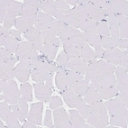 Immunohistochemical staining of human skeletal muscle shows low expression as expected.