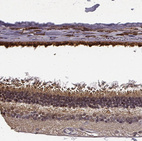 Anti-CRB1 Antibody