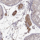 Immunohistochemical staining of human testis shows strong cytoplasmic positivity in Leydig cells.