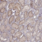 Immunohistochemical staining of human kidney shows moderate cytoplasmic positivity in cells in tubules.