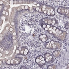 Immunohistochemical staining of human duodenum shows negative cytoplasmic positivity in glandular cells as expected.