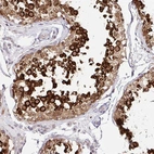 Anti-HPS1 Antibody