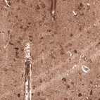 Immunohistochemical staining of human cerebral cortex shows moderate to strong cytoplasmic positivity in neurons.