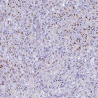 Anti-SDR42E2 Antibody