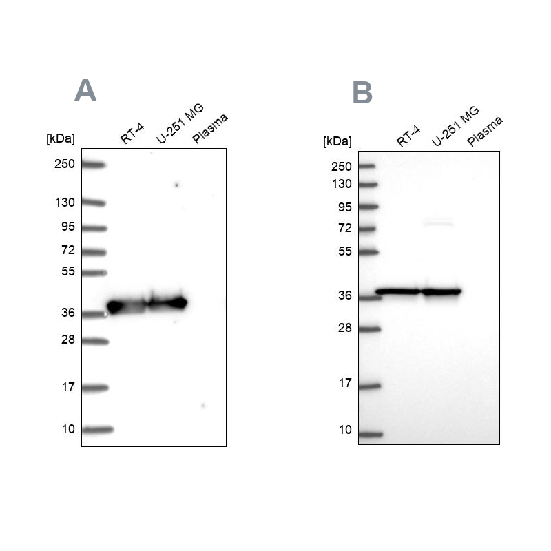 Anti-GAPDH Antibody