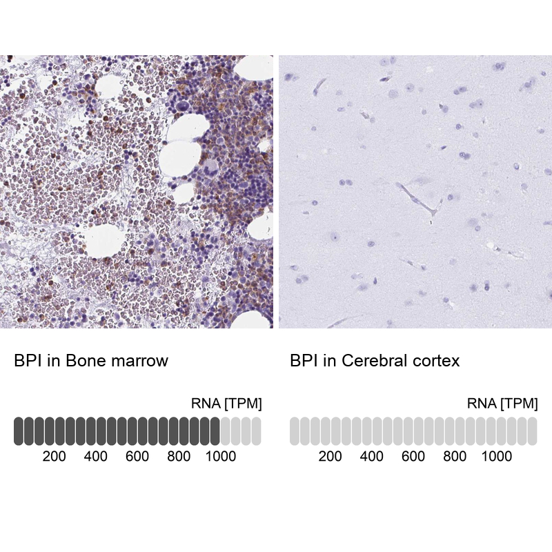 Anti-BPI Antibody