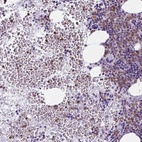 Immunohistochemical staining of human bone marrow shows high expression.