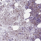 Immunohistochemical staining of human bone marrow shows high expression.