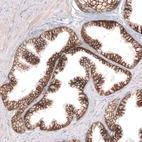 Immunohistochemical staining of human prostate shows strong membranous positivity in glandular cells.