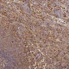 Anti-FGF21 Antibody