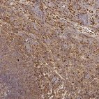 Anti-FGF21 Antibody