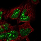 Immunofluorescent staining of human cell line HEK 293 shows localization to nucleus & nucleoli.