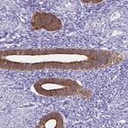 Anti-C1QTNF2 Antibody