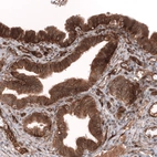 Immunohistochemical staining of human fallopian tube shows strong cytoplasmic and membranous positivity in glandular cells.