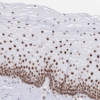 Immunohistochemical staining of human cervix, uterine shows strong nuclear positivity in squamous epithelial cells.