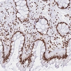 Immunohistochemical staining of human rectum shows strong nuclear positivity in glandular cells.