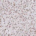 Immunohistochemical staining of human liver shows strong nuclear positivity in hepatocytes.