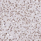 Immunohistochemical staining of human liver shows strong nuclear positivity in hepatocytes.