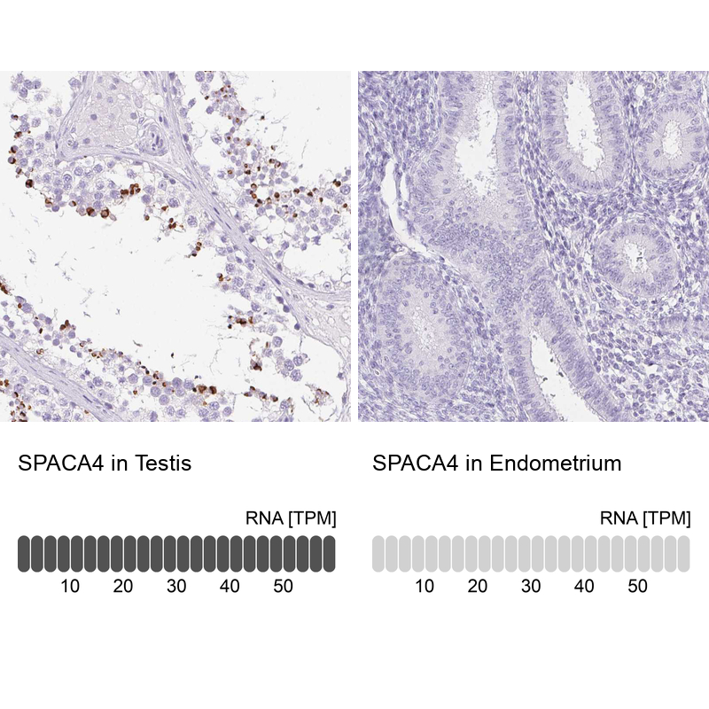 Anti-SPACA4 Antibody