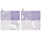 Anti-SPACA4 Antibody