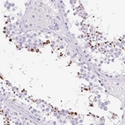 Immunohistochemical staining of human testis shows strong cytoplasmic-membranous positivity in cells in seminiferous ducts.