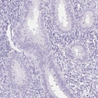 Immunohistochemical staining of human endometrium shows negative positivity in glandular cells as expected.