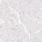 Anti-SPACA4 Antibody