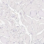Immunohistochemical staining of human skeletal muscle shows negative positivity in myocytes as expected.