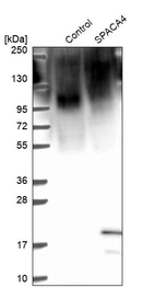 Western blot analysis in control (vector only transfected HEK293T lysate) and SPACA4 over-expression lysate (Co-expressed with a C-terminal myc-DDK tag (~3.1 kDa) in mammalian HEK293T cells, LY408827).