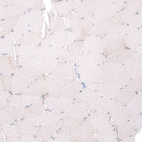 Immunohistochemical staining of human skeletal muscle shows no positivity in myocytes as expected.