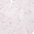 Immunohistochemical staining of human skeletal muscle shows no positivity in myocytes as expected.