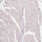 Immunohistochemical staining of human skeletal muscle shows low expression as expected.
