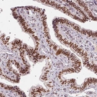 Immunohistochemical staining of human fallopian tube shows high expression.