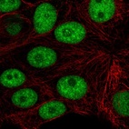 Anti-CD2BP2 Antibody