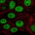Immunofluorescent staining of human cell line MCF7 shows localization to nuclear speckles & nucleoli fibrillar center.