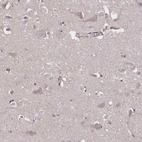 Immunohistochemical staining of human cerebral cortex shows weak cytoplasmic positivity in neurons.