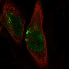 Immunofluorescence staining in RH-30 cell line with Anti-ADAM10 monoclonal antibody, showing specific staining of Golgi apparatus and nucleus in green. Microtubule- and nuclear probes are visualized in red and blue respectively (where available).