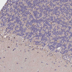 Immunohistochemical staining of human cerebellum shows no positivity in Purkinje cells as expected.